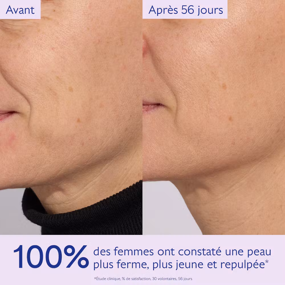 La Solution Fermeté