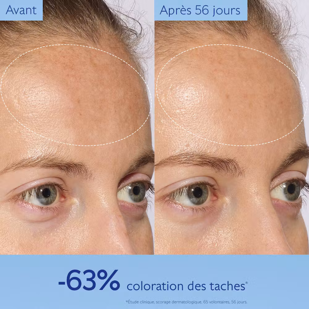 Photo avant-après 28 jours d'utilisation du Sérum Vinoperfect Caudalie : -63% de coloration des taches, résultats sans retouche