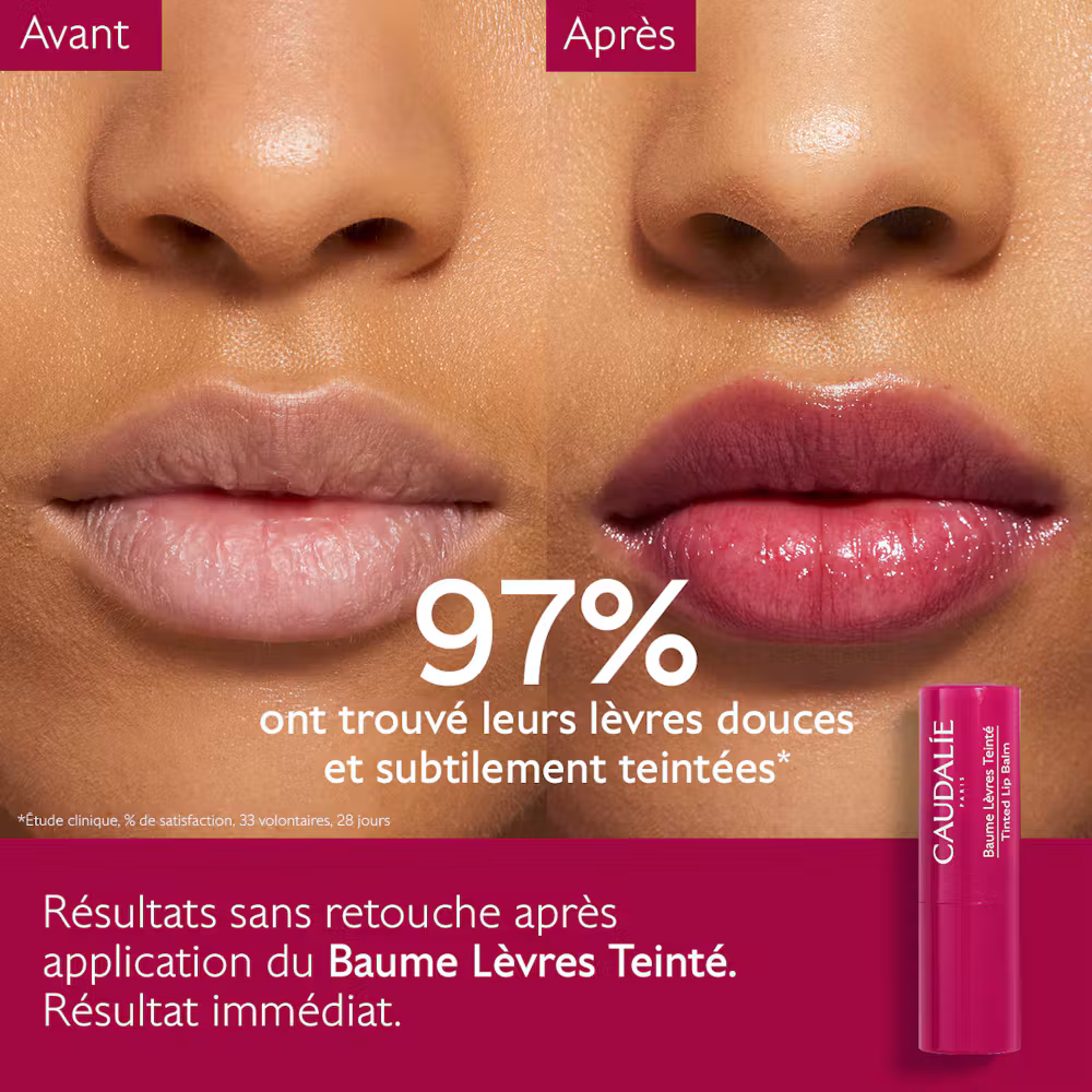 Coffret Bisous & Éclat