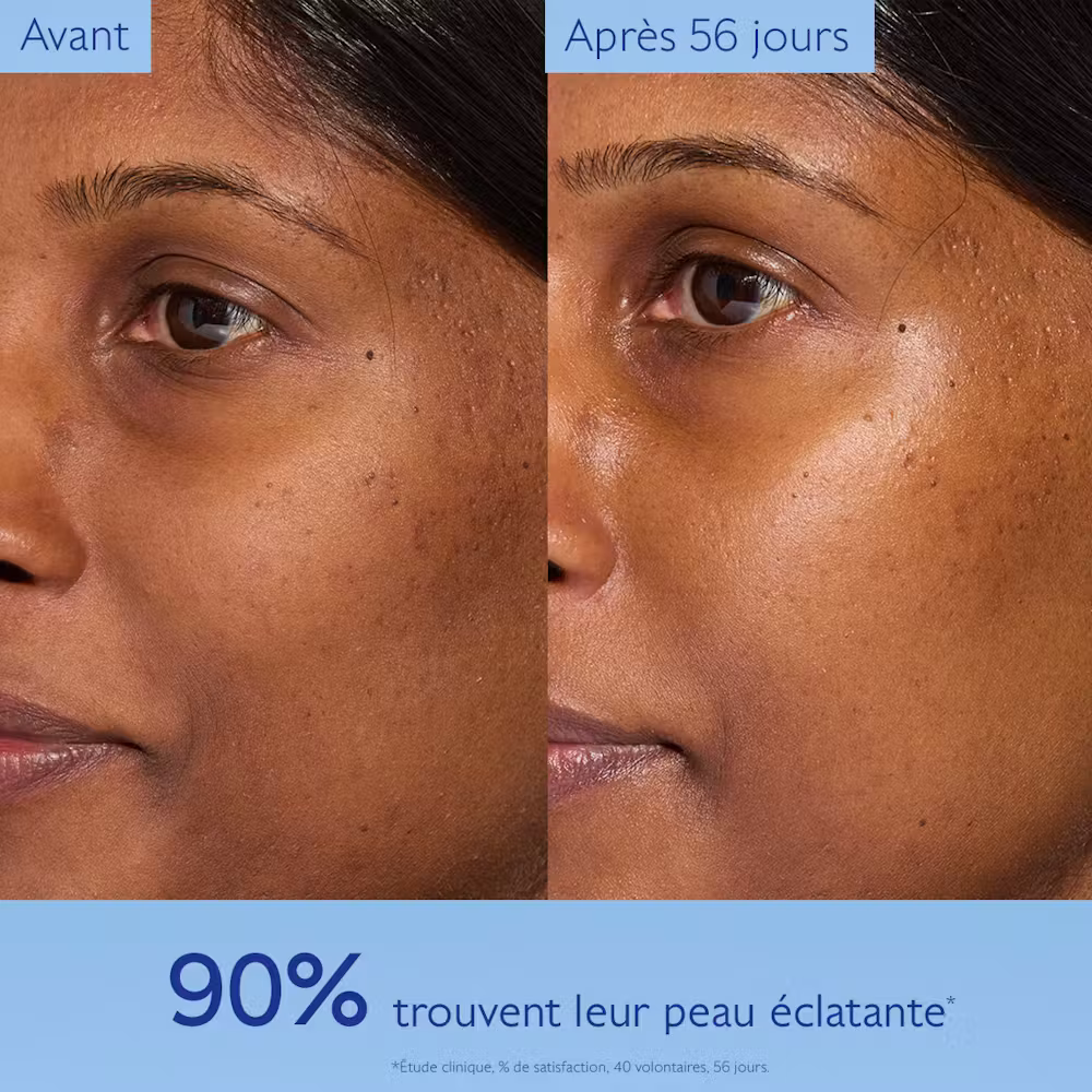 Photo avant-après 56 jours – Crème Nuit Vinoperfect Caudalie, 90% des femmes ont trouvé leur peau plus éclatante selon étude clinique